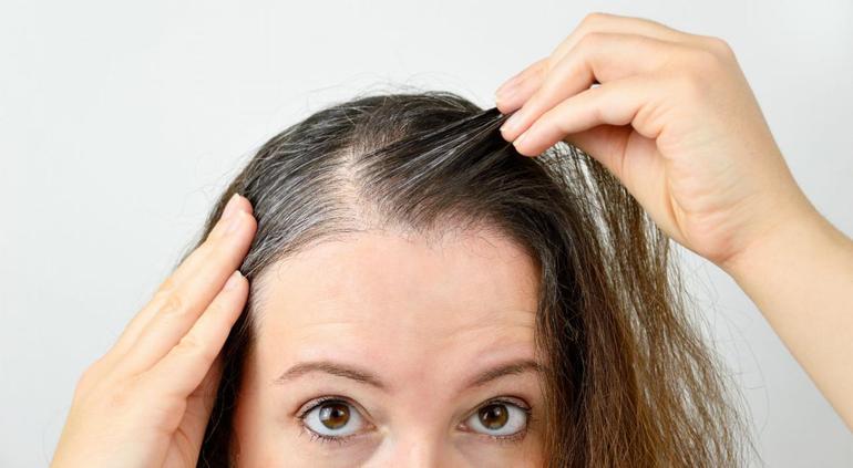 Así puede el cabello indicar falta de vitamina D