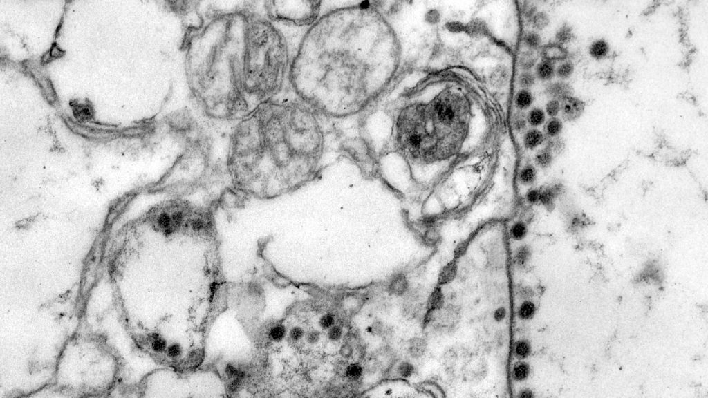 Coronavirus: un visitante inesperado | N+1: artículos científicos, noticias de ciencia, cosmos, gadgets, tecnología