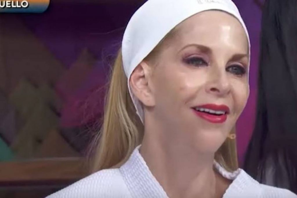 Shanik Berman se somete a intervenciones estéticas en su cuello