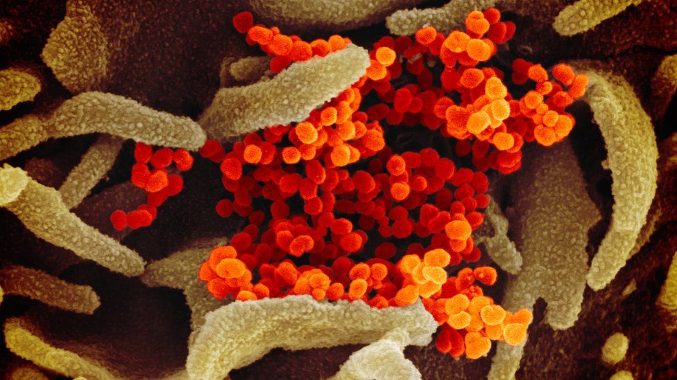 Estas son las imágenes microscópicas del coronavirus Covid-2019 | Fotos